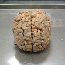 Brain by karmaowl
